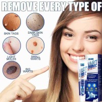 EELHOE Wart Remover Ointment Cream